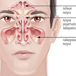 Роман, Заринск